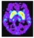 pet_brain.jpg
