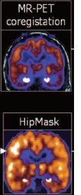 hipmask.jpg