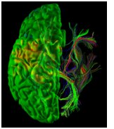 neurolens_brain.jpg