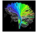 diffusion_tensor_image.jpg