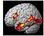 fMRI-Mini.jpg