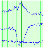 slow_wave_trace.jpg