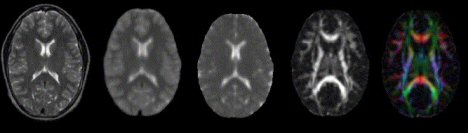 child_mri.jpg
