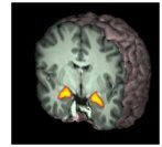 superbowl_amygdala.jpg