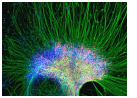 Zhang_neural_stem_cells04s.jpg