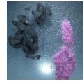 presume_morgellons_fibres.jpg