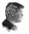 Brain_Expose_by_PatrickPower.jpg