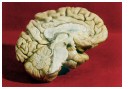 red_bg_brain.jpg