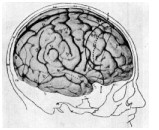 Ruth Wilder surgical drawing